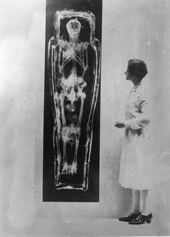 X-ray of Egyptian mummy Museum of Natural History circa 1935