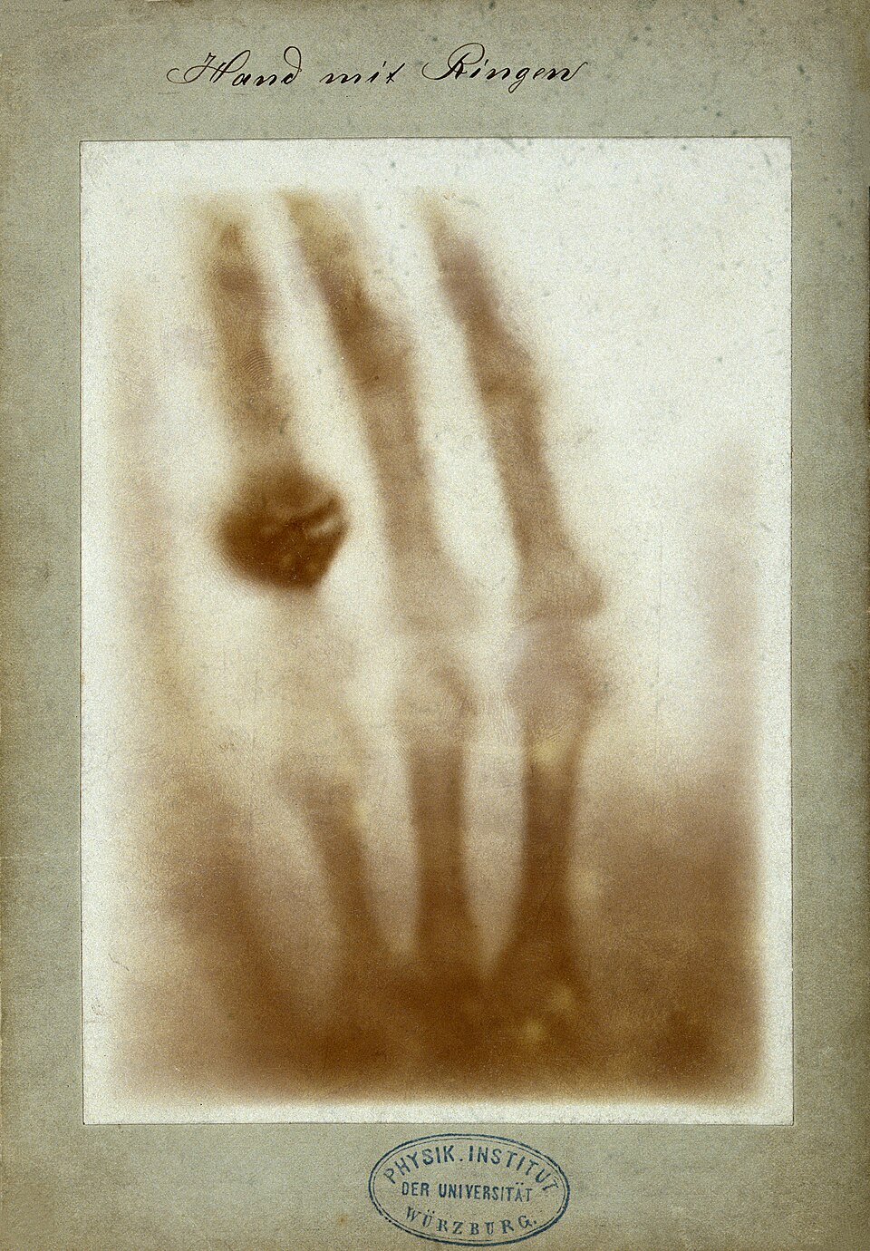 First X-ray of human hand, 1896